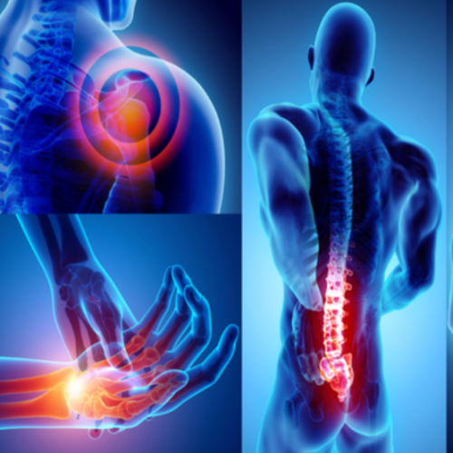 Illustration of pain areas related to musculoskeletal disorders (MSDs)